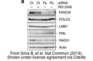 Anti-Lamin B1 antibody used in Western Blot (WB). GTX103292