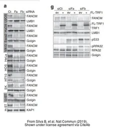 Anti-Lamin B1 antibody used in Western Blot (WB). GTX103292
