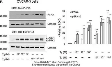Anti-Lamin B1 antibody used in Western Blot (WB). GTX103292