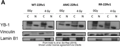 Anti-Lamin B1 antibody used in Western Blot (WB). GTX103292