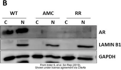 Anti-Lamin B1 antibody used in Western Blot (WB). GTX103292
