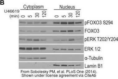 Anti-Lamin B1 antibody used in Western Blot (WB). GTX103292