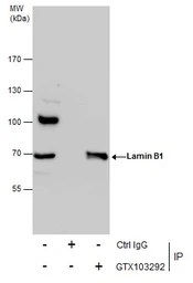 Anti-Lamin B1 antibody used in Immunoprecipitation (IP). GTX103292
