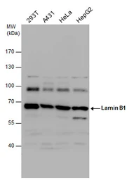 Anti-Lamin B1 antibody used in Western Blot (WB). GTX103292