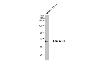 Anti-Lamin B1 antibody used in Western Blot (WB). GTX103292