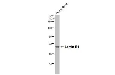 Anti-Lamin B1 antibody used in Western Blot (WB). GTX103292