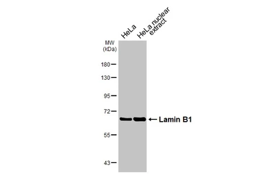 Anti-Lamin B1 antibody used in Western Blot (WB). GTX103292