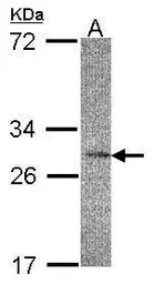 Anti-IL22 Receptor alpha 2 antibody used in Western Blot (WB). GTX103302
