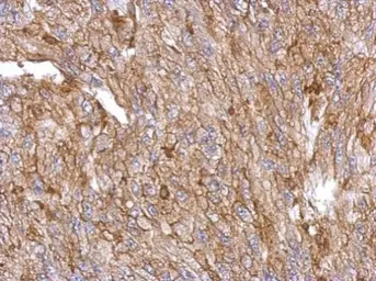 Anti-Annexin III antibody used in IHC (Paraffin sections) (IHC-P). GTX103330