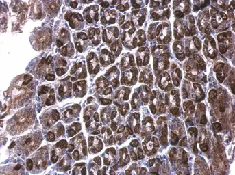 Anti-ALDH6A1 antibody used in IHC (Paraffin sections) (IHC-P). GTX103405