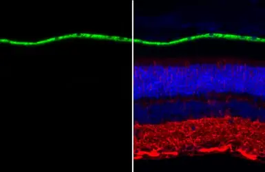 Anti-RPE65 antibody [N1C3] used in IHC (Paraffin sections) (IHC-P). GTX103472