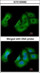 Anti-UAP1 antibody [N1C3] used in Immunocytochemistry/ Immunofluorescence (ICC/IF). GTX103592