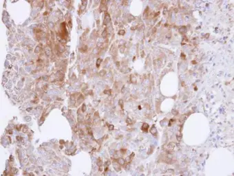 Anti-UAP1 antibody [N1C3] used in IHC (Paraffin sections) (IHC-P). GTX103592