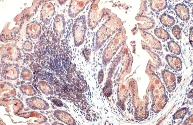 Anti-CYR61 antibody [N1C3] used in IHC (Paraffin sections) (IHC-P). GTX103669