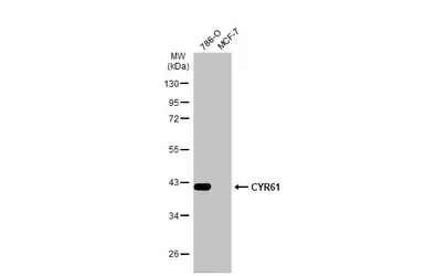 Anti-CYR61 antibody [N1C3] used in Western Blot (WB). GTX103669