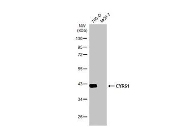Anti-CYR61 antibody [N1C3] used in Western Blot (WB). GTX103669