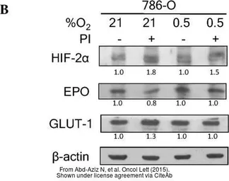Anti-HIF2 alpha antibody [N1N3] used in Western Blot (WB). GTX103707