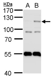 Anti-HIF2 alpha antibody [N1N3] used in Western Blot (WB). GTX103707