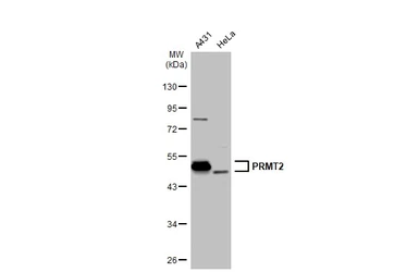 Anti-PRMT2 antibody [N1C2] used in Western Blot (WB). GTX103749