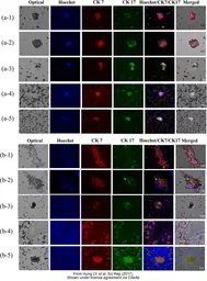 Anti-Cytokeratin 17 antibody used in Immunocytochemistry/ Immunofluorescence (ICC/IF). GTX103765