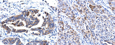 Anti-Cytokeratin 17 antibody used in IHC (Paraffin sections) (IHC-P). GTX103765