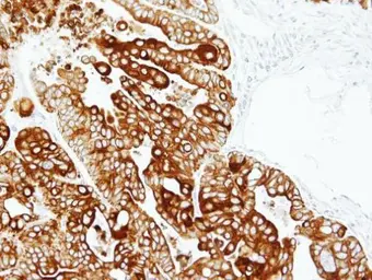Anti-Cytokeratin 17 antibody used in IHC (Paraffin sections) (IHC-P). GTX103765