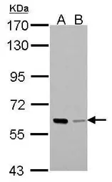 Anti-PAK1 antibody used in Western Blot (WB). GTX103797