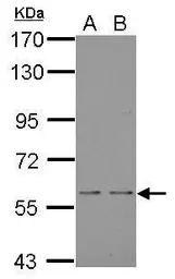 Anti-NOX1 antibody used in Western Blot (WB). GTX103888