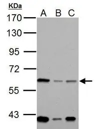 Anti-NOX1 antibody used in Western Blot (WB). GTX103888