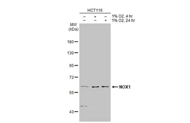 Anti-NOX1 antibody used in Western Blot (WB). GTX103888