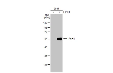 Anti-IP6K1 antibody used in Western Blot (WB). GTX103949
