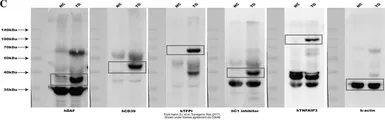 Anti-CD55 antibody [N2C3] used in Western Blot (WB). GTX103951
