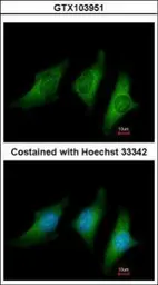 Anti-CD55 antibody [N2C3] used in Immunocytochemistry/ Immunofluorescence (ICC/IF). GTX103951