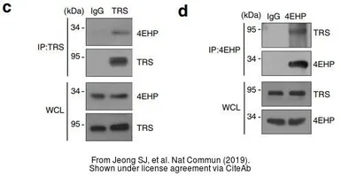 Anti-EIF4E2 antibody [N1C3] used in Western Blot and Immunoprecipitation (WB IP). GTX103977