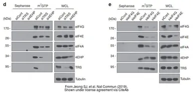 Anti-EIF4E2 antibody [N1C3] used in Western Blot (WB). GTX103977