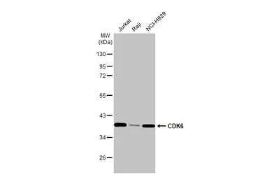 Anti-CDK6 antibody [N1C3] used in Western Blot (WB). GTX103992