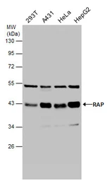 Anti-LRPAP1 antibody [N1C3] used in Western Blot (WB). GTX104033