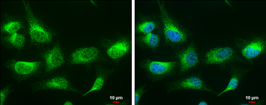 Anti-LRPAP1 antibody [N1C3] used in Immunocytochemistry/ Immunofluorescence (ICC/IF). GTX104033