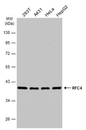 Anti-RFC4 antibody [N1C3] used in Western Blot (WB). GTX104052