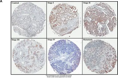 Anti-PON2 antibody [N1C2] used in IHC (Paraffin sections) (IHC-P). GTX104061