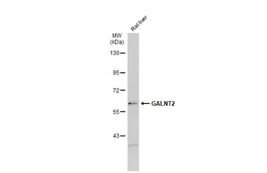 Anti-GALNT2 antibody used in Western Blot (WB). GTX104070
