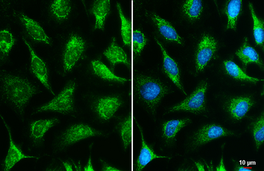Anti-IDH3A antibody used in Immunocytochemistry/ Immunofluorescence (ICC/IF). GTX104073