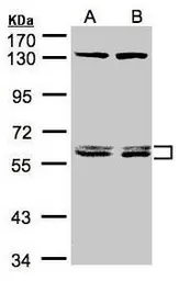 Anti-DNAJC7 antibody [N2C3] used in Western Blot (WB). GTX104079