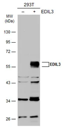 Anti-EDIL3 antibody used in Western Blot (WB). GTX104086