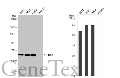 Anti-ME1 antibody used in Western Blot (WB). GTX104122