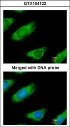 Anti-ME1 antibody used in Immunocytochemistry/ Immunofluorescence (ICC/IF). GTX104122