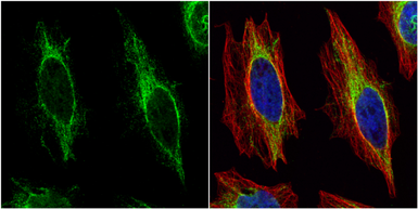 Anti-Cytokeratin 14 antibody used in Immunocytochemistry/ Immunofluorescence (ICC/IF). GTX104124