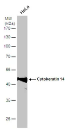 Anti-Cytokeratin 14 antibody used in Western Blot (WB). GTX104124
