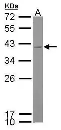 Anti-Kallikrein 11 antibody [N1C3] used in Western Blot (WB). GTX104200