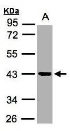 Anti-Kallikrein 11 antibody [N1C3] used in Western Blot (WB). GTX104200